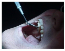 Harjavallan koulun elokuvatyöpajassa syntyi mm. elokuva Hammaslääkärissä vuonna 2001